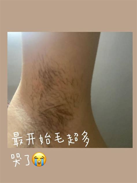 阴毛长度